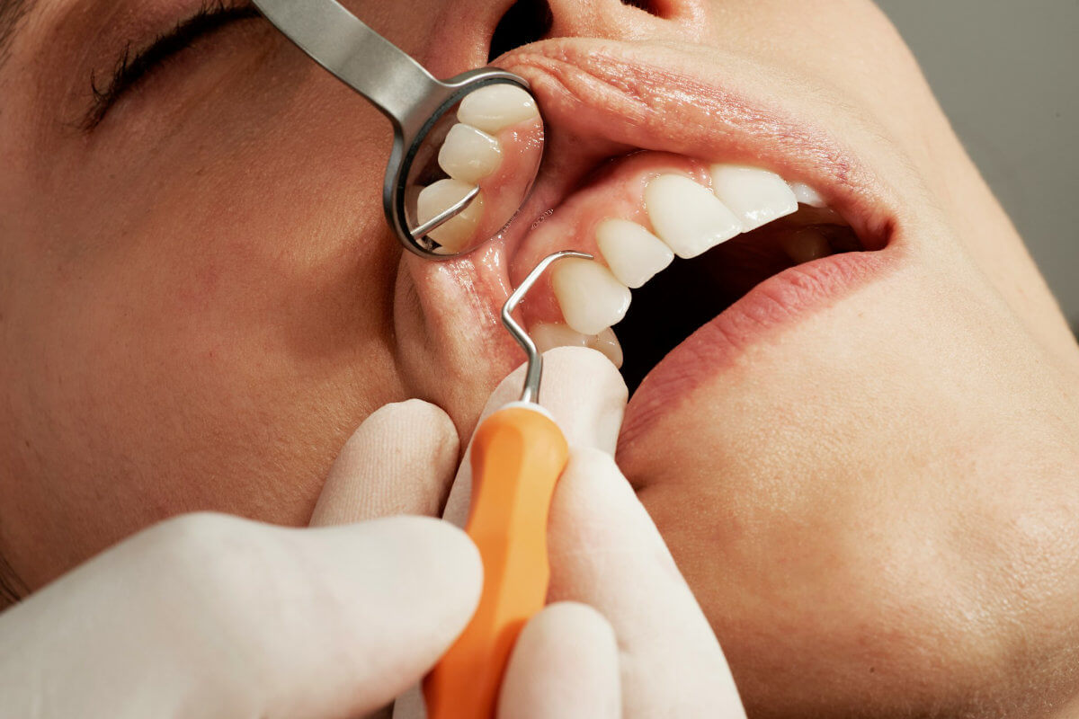 Dentista atendioendo a una persona Persona recibiendo tratamiento dental en Ciudad Juarez